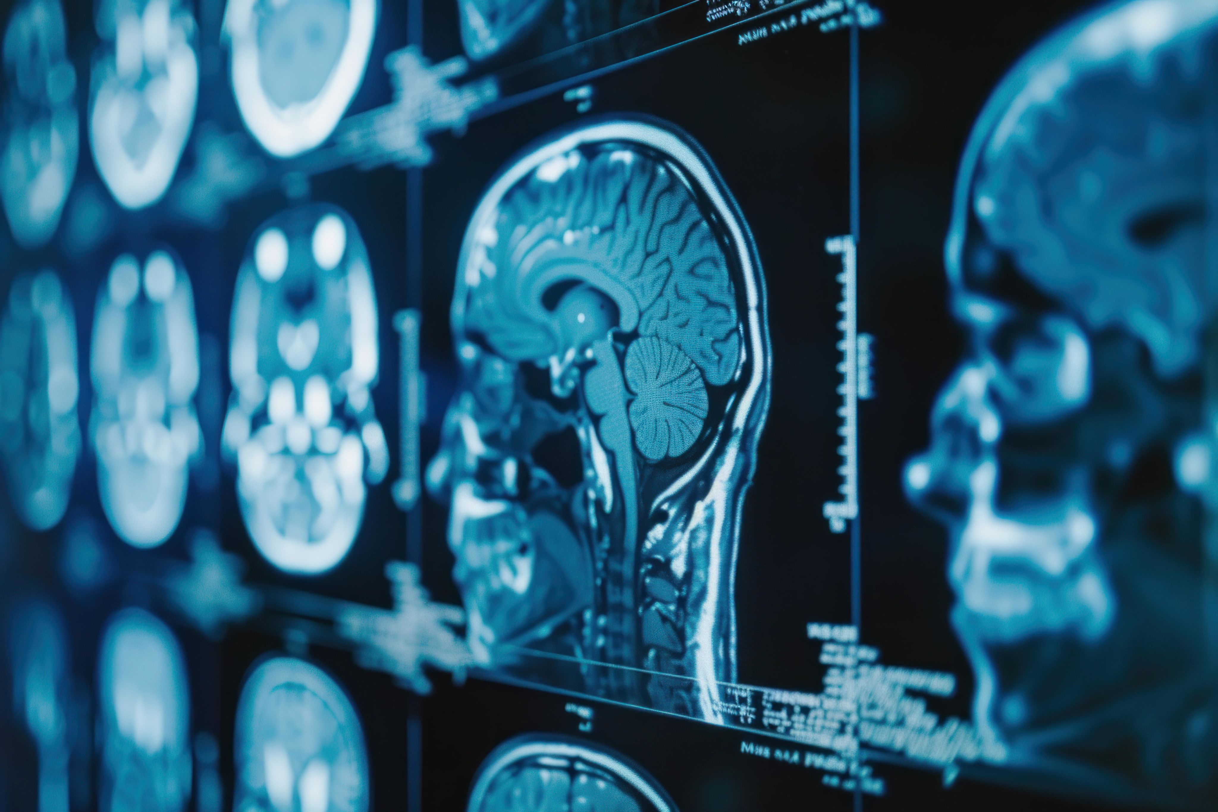 2 vintage cars in a driveway